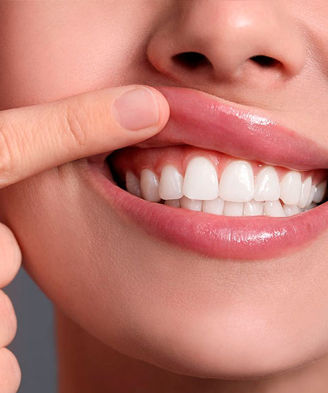 Tratamientos Dentales en Móstoles