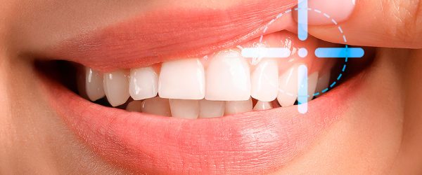 Tratamientos Dentales Móstoles